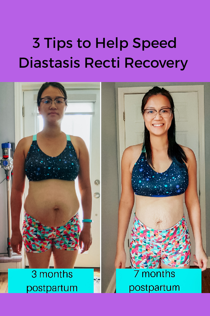 Diastasis Recti Nutrition  3 Tips to Help Diastasis Recti Recovery